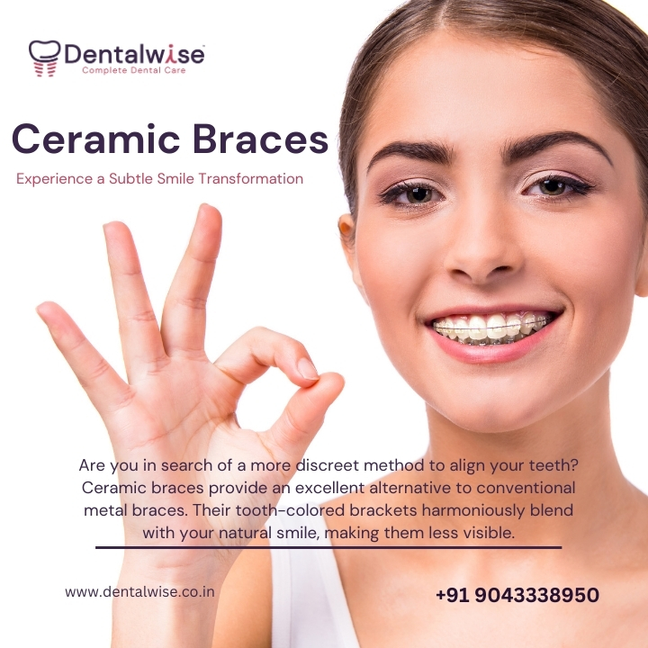 Ceramic braces